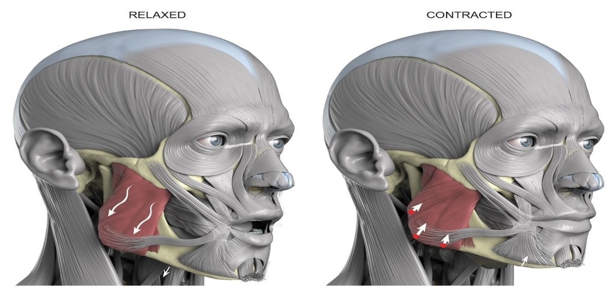 masseter muscle - strongest muscel in human body